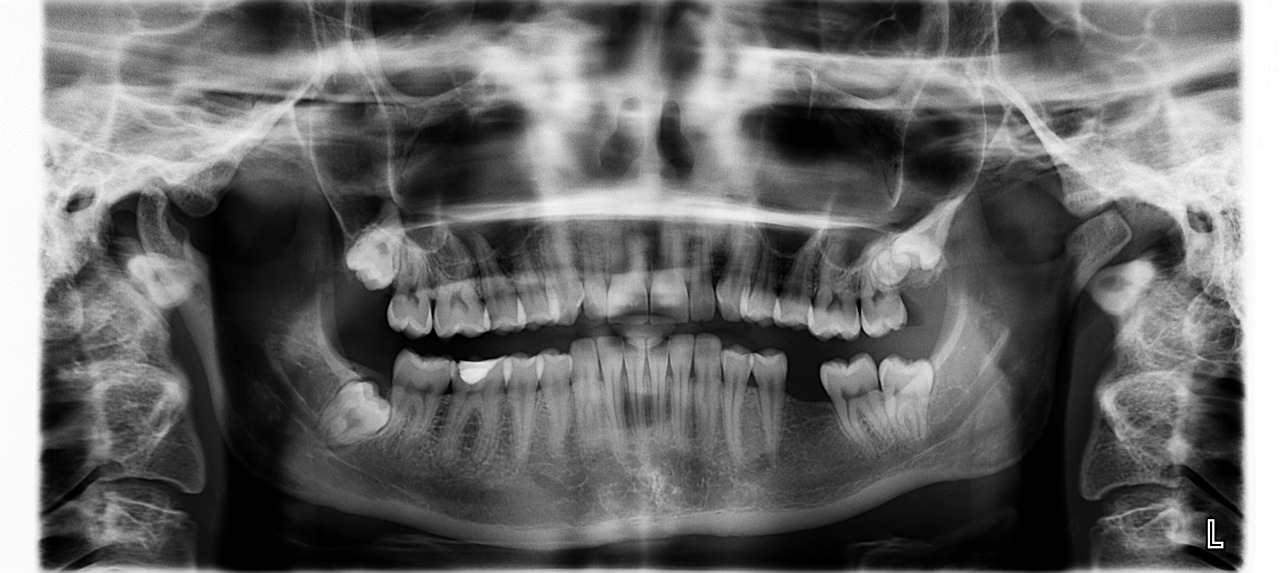 Dental XRays and Your Health Waterford, CT
